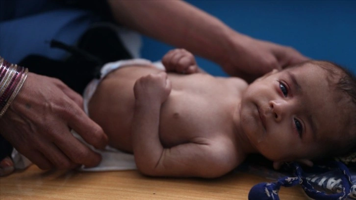 Afganistan’da 10 milyon bebek kesat tehlikesi altında