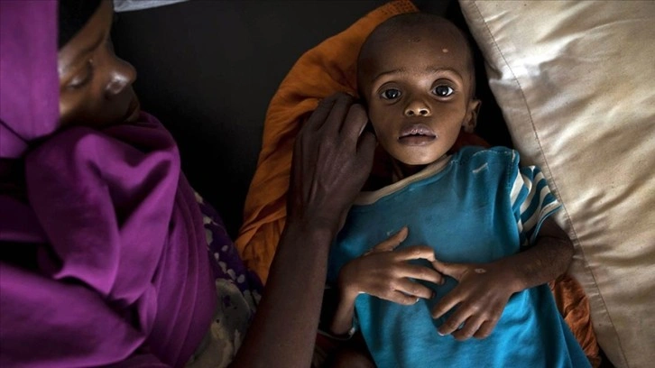 Somali'de kuraklık zımnında 3 insan öldü