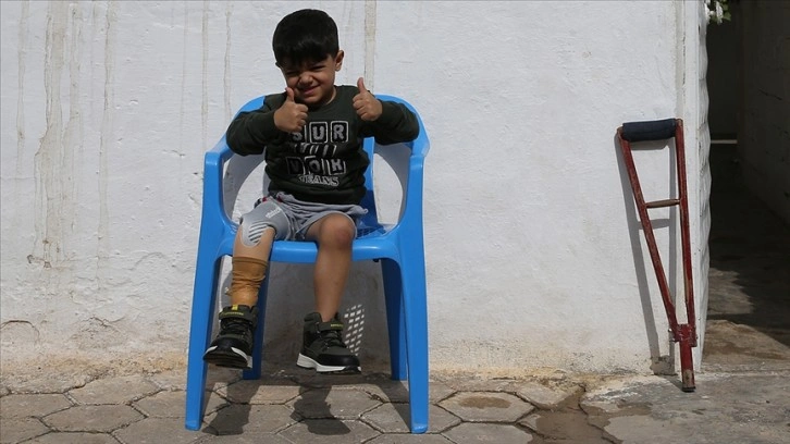 Suriyeli Muhammed yaşama tutunacağı protez bacağa kavuştu