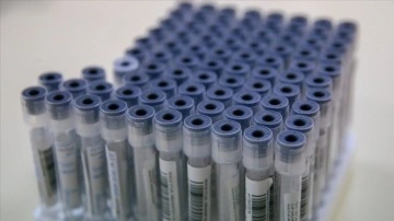 Bazı bölgelerde PCR testi zorunluluğu kaldırıldı