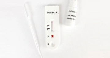 Çekya’da PCR ve antijen testlerinin geçerliliği kaldırılıyor