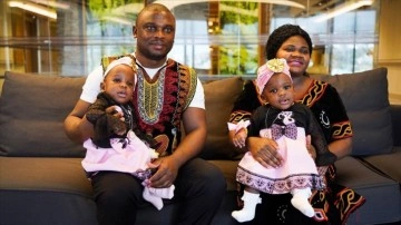 İstanbul'da ayrılan Kamerunlu siyam ikizlerin ailesinden Türkiye'ye teşekkür