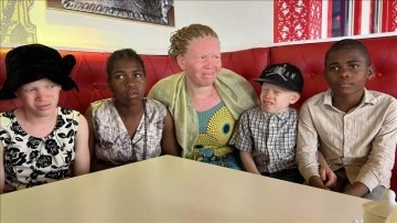 Kamerun’da albinoslar afsun ve temelsiz inançlar yüzünden gözdağı altında