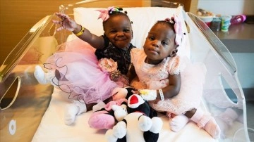 Kamerun'da dünyaya mevrut değen siyam ikizleri, Türkiye'de felah buldu