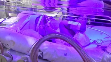 'Prematüre bebekler derneşik izleme edilmeyen hamilelikten doğuyor' uyarısı